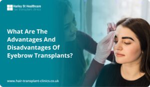 What Are the Advantages and Disadvantages of Eyebrow Transplants?
