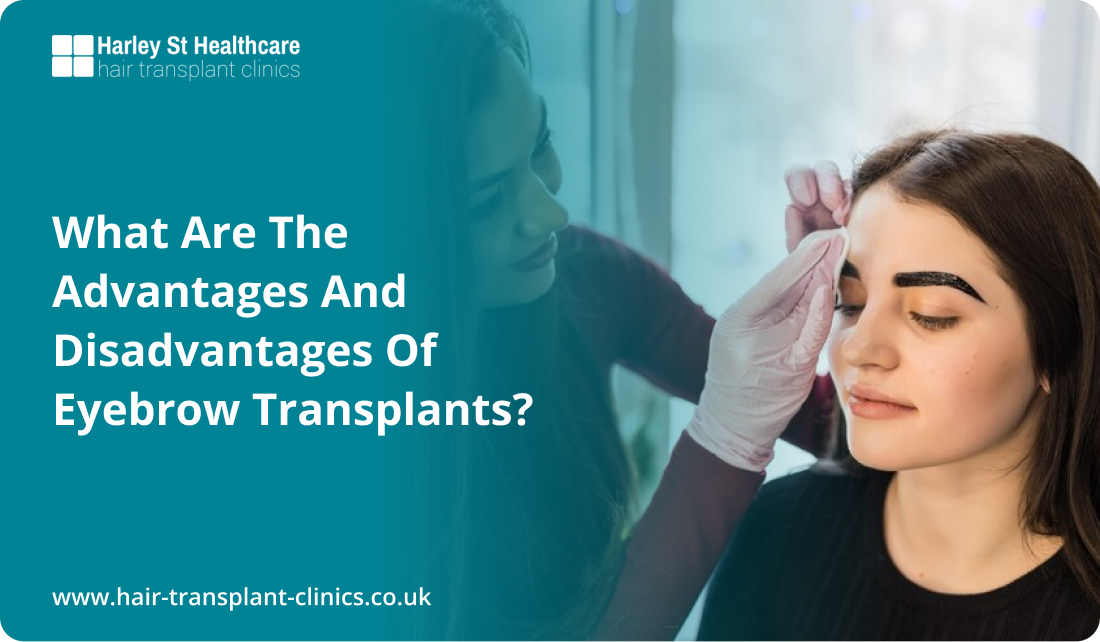 What Are the Advantages and Disadvantages of Eyebrow Transplants?