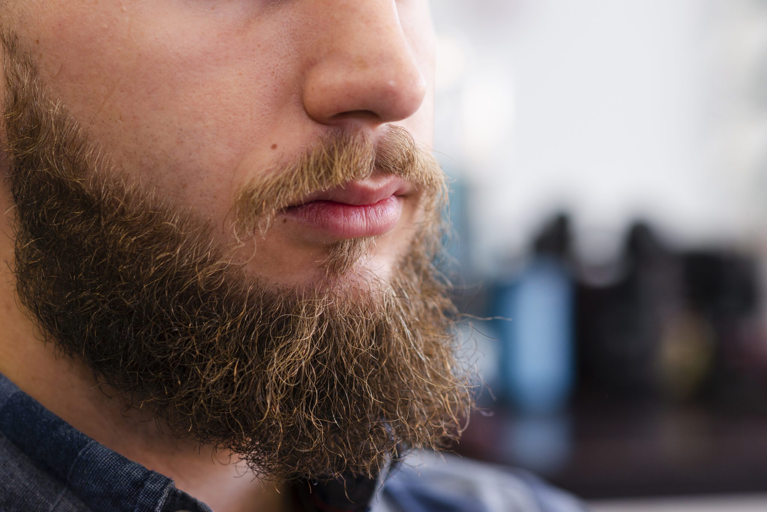 How Long Does It Take to Look Normal After a Beard Transplant?