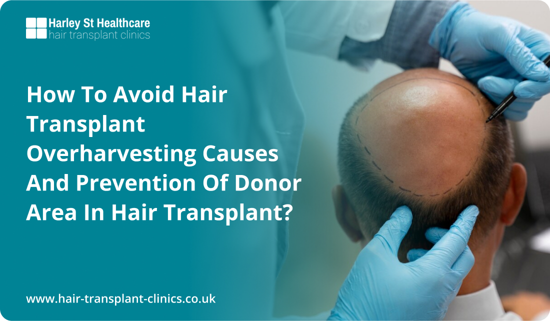 How to Avoid Hair Transplant Overharvesting Causes and Prevention of Donor Area in Hair Transplant?
