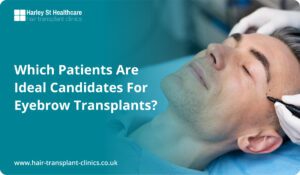 Which Patients Are Ideal Candidates for Eyebrow Transplants?
