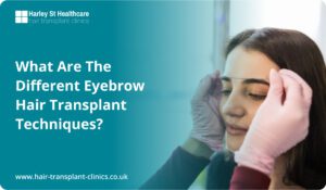 Best Eyebrow Hair Transplant Techniques Explained
