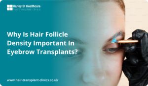 Why is Hair Follicle Density Important in Eyebrow Transplants?