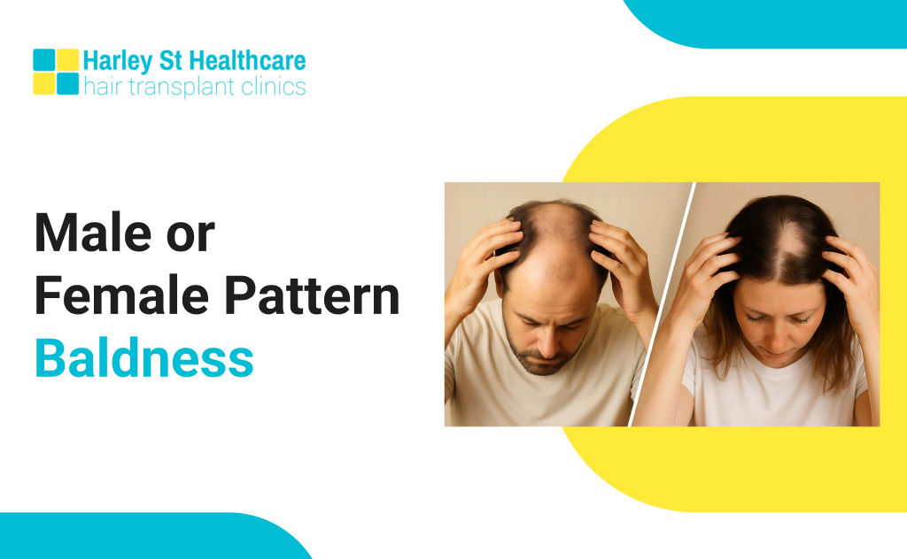 Male or Female Pattern Baldness