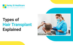 Types of Hair Transplants