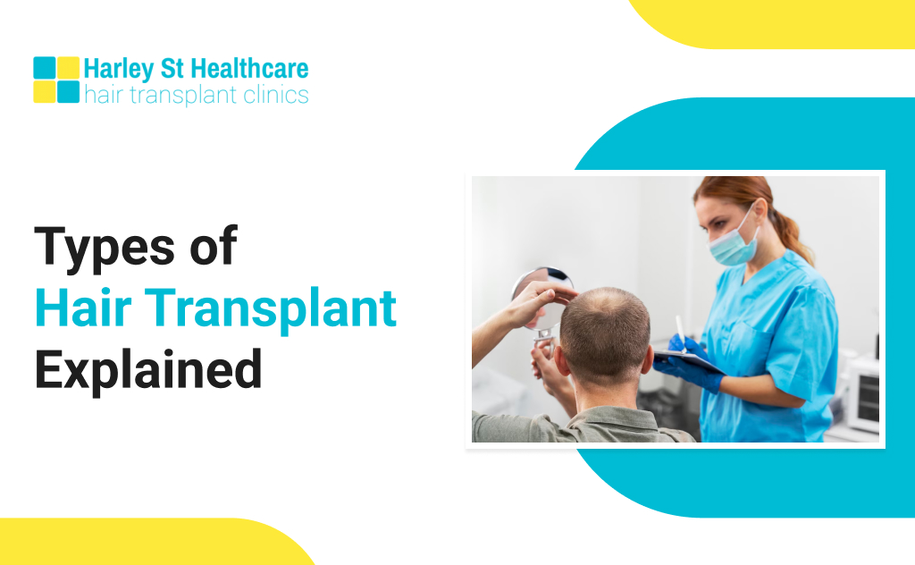 Types of Hair Transplants