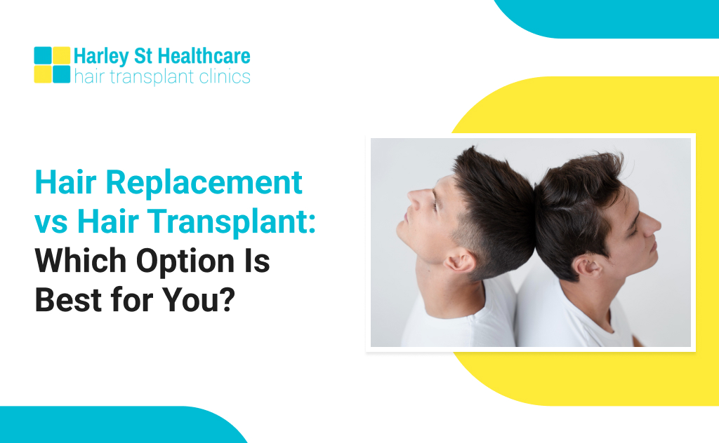 Hair Replacement vs Hair Transplant