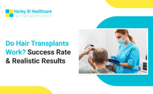 Do Hair Transplants Work? Success Rate & Realistic Results