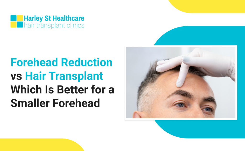 Forehead Reduction vs Hair Transplant Which Is Better for a Smaller Forehead