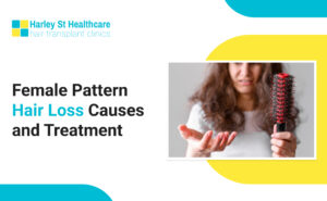 Female Pattern Hair Loss: Causes, Diagnosis