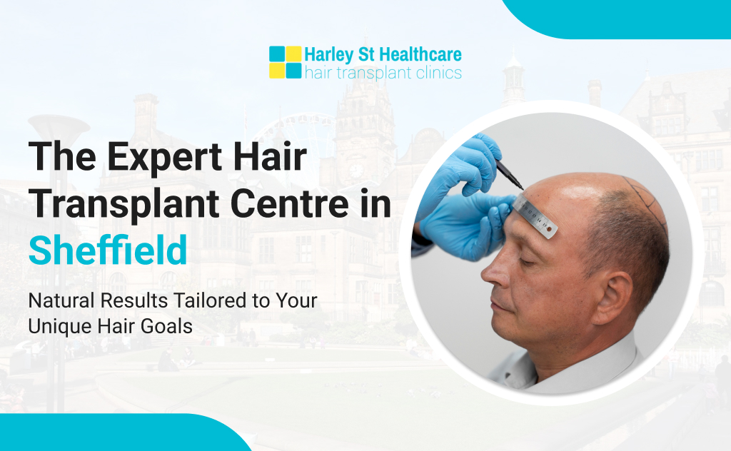 Hair Transplant in Sheffield
