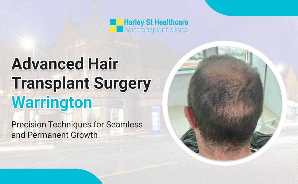 Hair Transplant Warrington | FUE, FUT &amp; Natural Results