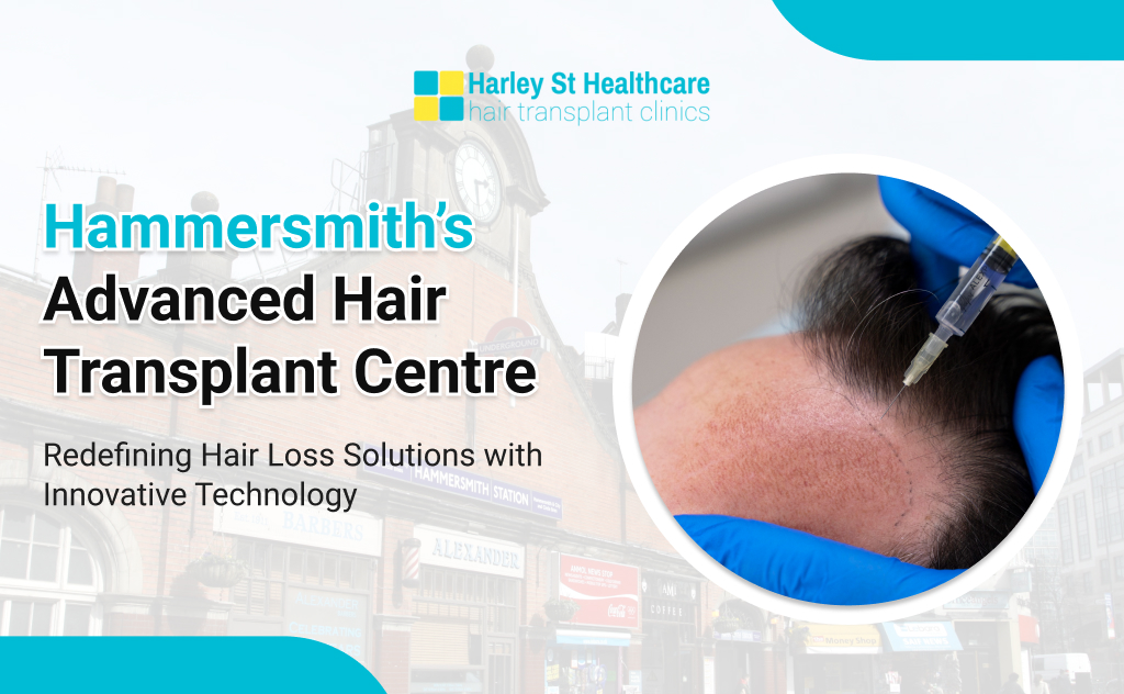 Hair Transplant in Hammersmith