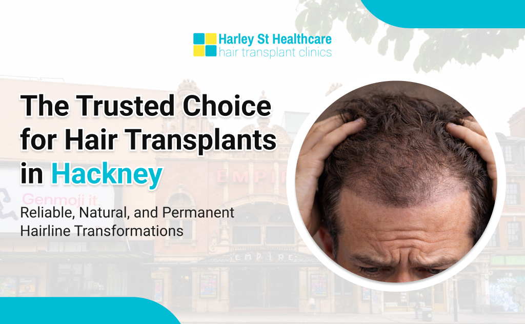 Hair Transplant in Hackney