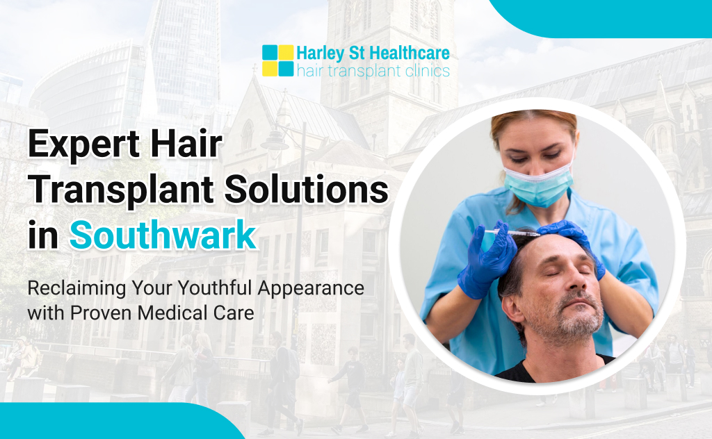 Hair Transplant in Southwark