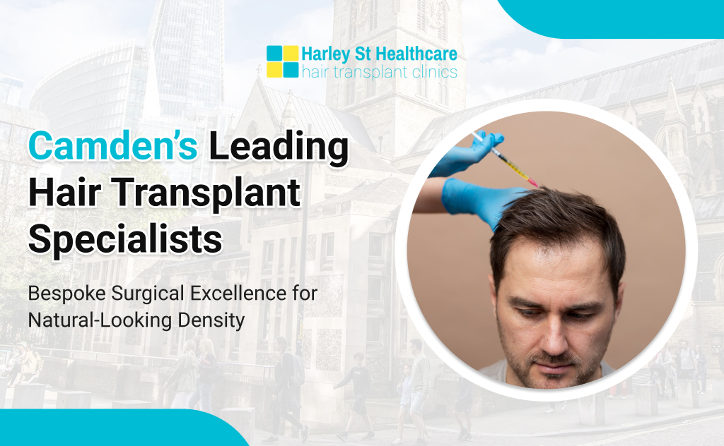 Hair Transplant in Camden