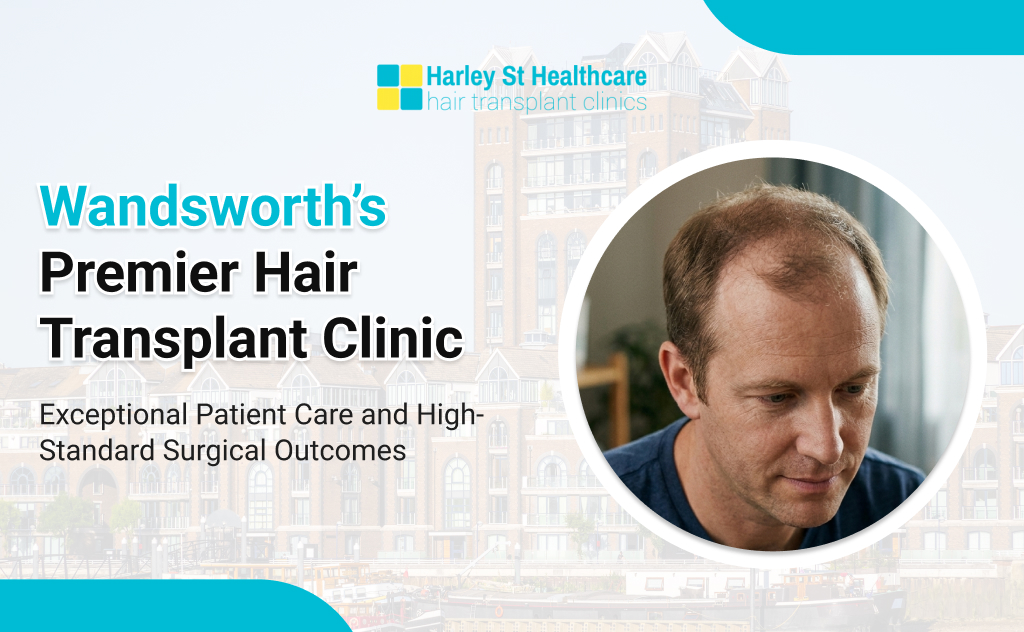 Hair Transplant in Wandsworth
