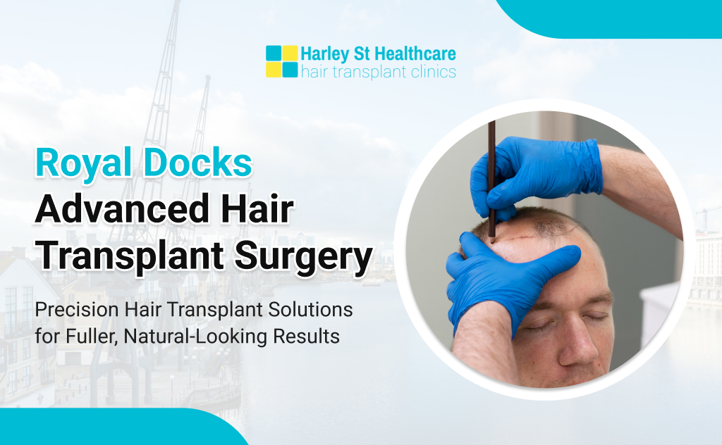 Hair Transplant in Royal Docks