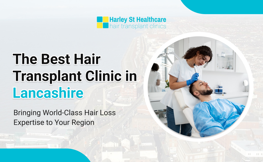 Hair Transplant in Lancashire