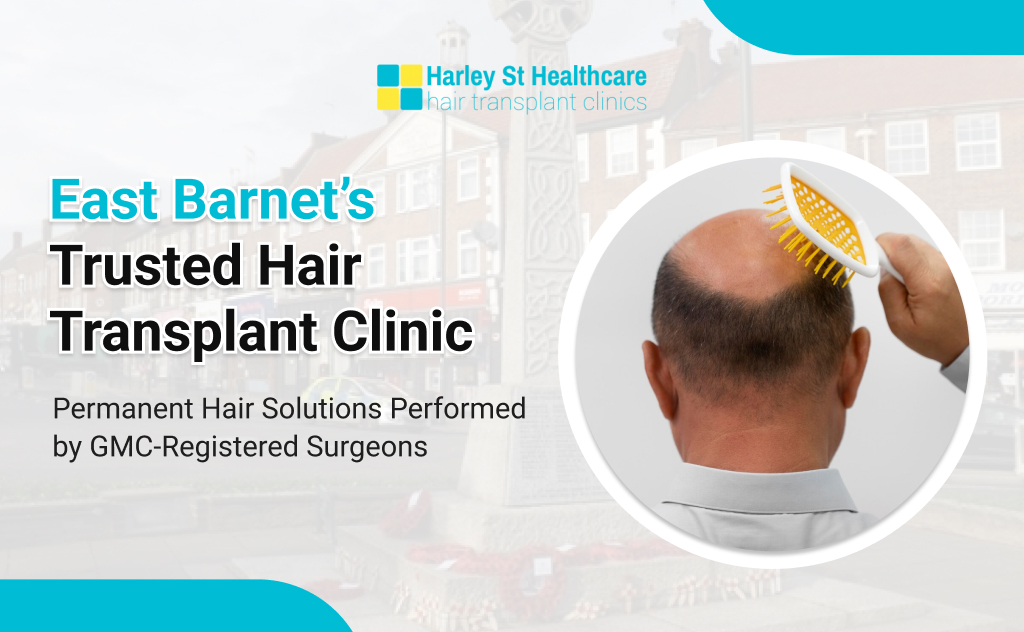 Hair Transplant in East Barnet