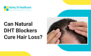 Can Natural DHT Blockers Cure Hair Loss?