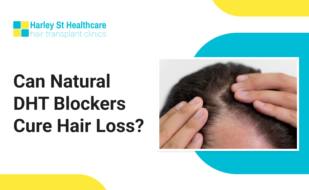 Can Natural DHT Blockers Cure Hair Loss?