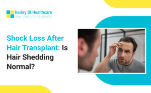 Shock Loss After Hair Transplant: Is Hair Shedding Normal