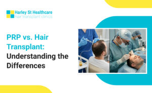 PRP vs Hair Transplant: Which Hair Loss Treatment Is Right for You?