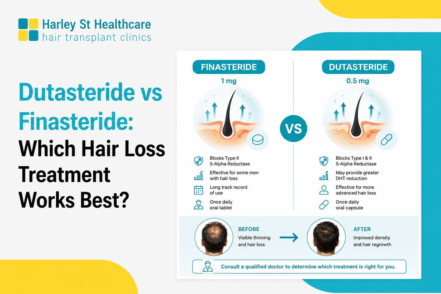 Dutasteride Vs Finasteride: Which Treatment Works Best