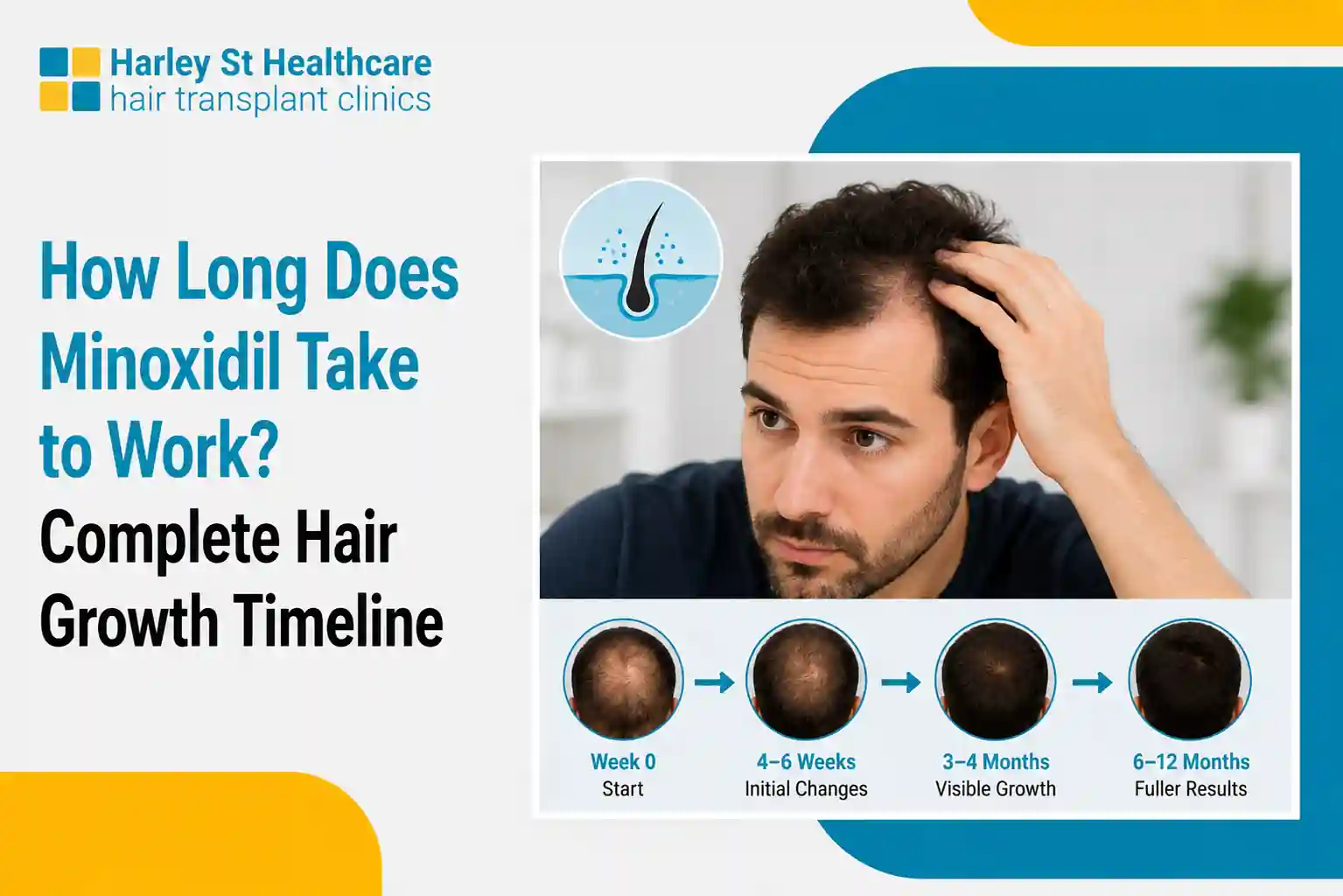 How Long Does Minoxidil Take to Work