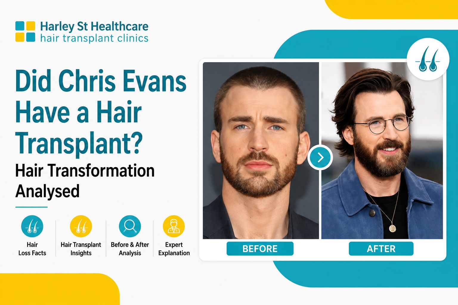 Chris Evans Hair Transformation