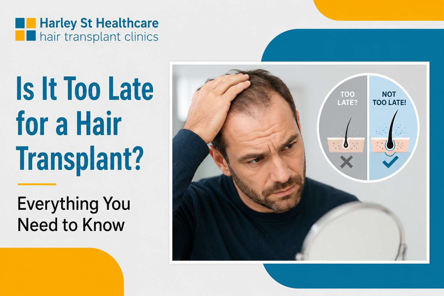 Is It Too Late for a Hair Transplant?