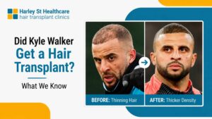 Did Kyle Walker Get a Hair Transplant? What We Know