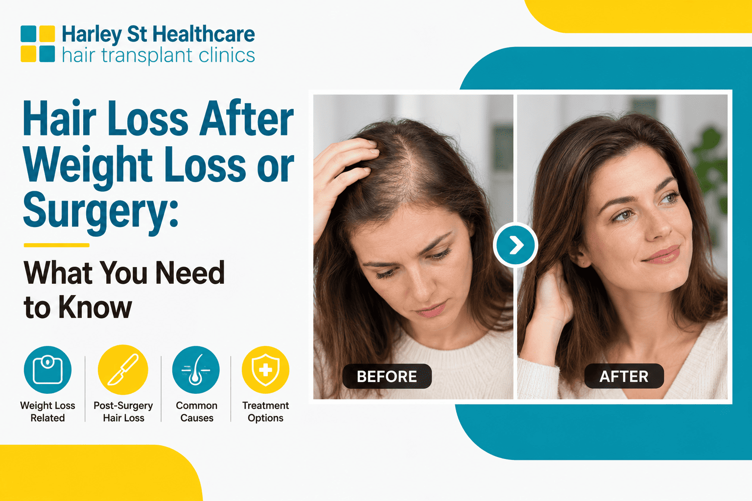 Hair Loss After Weight Loss or Surgery