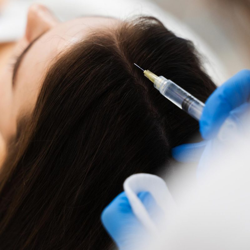 female hair transplant